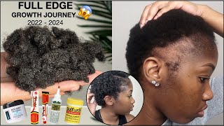 TWO YEAR EDGE GROWTH JOURNEY HOW I GREW MY EDGES  MICRO NEEDLING  DO I STILL USE DOO GRO [upl. by Ahtenak303]