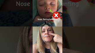 What does CROUP sound like amp Home Treatment for Croup [upl. by Asseram]