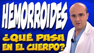 HEMORROIDES o ALMORRANAS  ¿Qué pasa dentro de las personas que las padecen [upl. by Slein720]