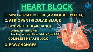 Heart Block  SA Block  AV Block 1st 2nd Mobitz 1 amp 2 3rd Degree  Bundle Branch Block  ECG [upl. by Timmi153]