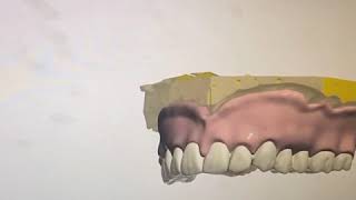 3shape design full denture [upl. by Dugas295]