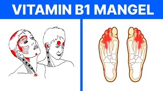 10 Anzeichen dafür dass Sie an Vitamin B1 Thiamin mangeln [upl. by Shlomo856]