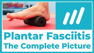 The Most Complete Picture of Plantar Fasciitis on YouTube The Entire Series In One [upl. by Ttekcirc]