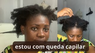 Meu cabelo está caindoatravés da dermatite seborreica [upl. by Oemac]