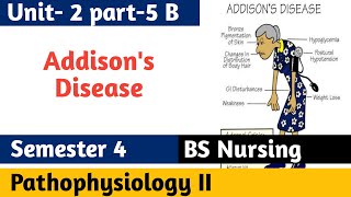 Addisons Disease  Overview causes treatment clinical features pathophysiology investigations [upl. by Bedell700]