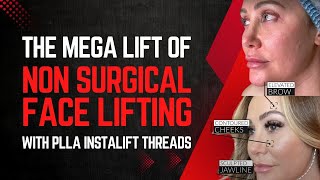 THE MEGA LIFT OF NON SURGICAL FACE LIFTING WITH PLLA INSTALIFT THREADS  Dr Jason Emer [upl. by Nomrac]