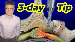 Physical Therapy after Lumbar Laminectomy 03 Day Secrets for Success [upl. by Isoj]