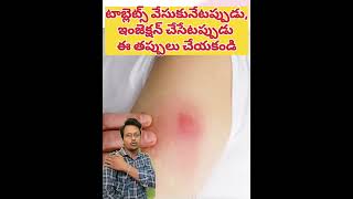 టాబ్లెట్స్ ఇలాగే వేసుకోవాలని తెలియక తప్పు చేశా healthtips doctor medicalprofession paramparik [upl. by Hamehseer6]