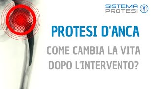 🔵 PROTESI ANCA Testimonianza di Lorenzo Lorenzi ▷▷ Come CAMBIA LA VITA dopo lintervento 🏍️ [upl. by Longerich999]