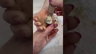 Removing callus from kid hands  Keratoderma hyperkeratosis EPPK skin shaving callous  Apr 2 2023 [upl. by Eixirt]