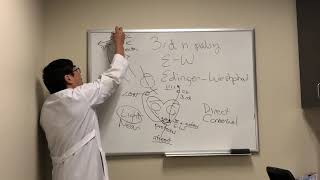 Third nerve palsy vs Edinger Westphal lesion [upl. by Goulden]