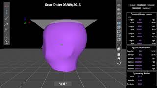 Measurement amp Comparison Utility  Orthomerica 3D Scanning [upl. by Ecyak]