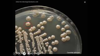 Candida albicans culture pathogenesis and laboratory diagnosis [upl. by Griffiths202]