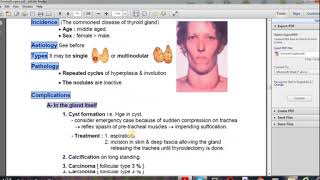 goiter thyroid 2 شرح [upl. by Merle]