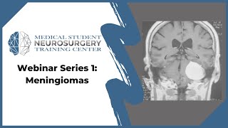 Webinar Series 1 Meningiomas [upl. by Gurl]