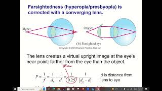 The eye and calculating lens prescriptions [upl. by Annayar]