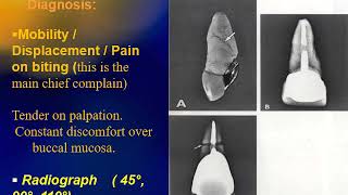 Fall 2020  Endodontics 3  Lec 9  Traumatic dental injuries Part 2 [upl. by Anna]