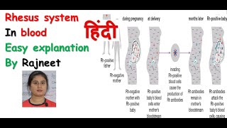 Rhesus system in hindi  Rh incompatibility  haemolytic disease  Rj medical education [upl. by Reivilo218]