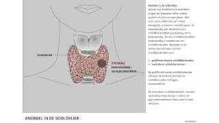 Nodus een knobbel in de schildklier [upl. by Soloma887]