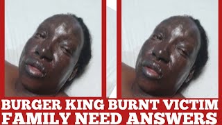 Family Quarrel Over Burger King Burnt Victim money to Pay Air Ambulance [upl. by Yeltrab]