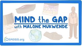 Mind the Gap with Malone Mukwende [upl. by Aldercy]