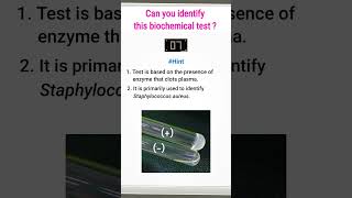 Quiz9  Biochemical test for identification of bacteria  shorts microbiology [upl. by Sharma260]