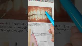 Marginal gingiva [upl. by Namad1]