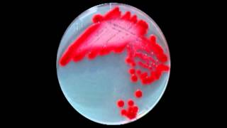 Serratia [upl. by Tedder]