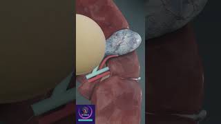 Gallbladder Attached With Liver GALLBLADDER [upl. by Ffej]