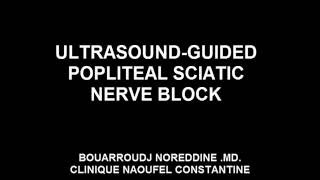 ULTRASOUND GUIDED POPLITEAL SCIATIC NERVE BLOCK [upl. by Angie861]