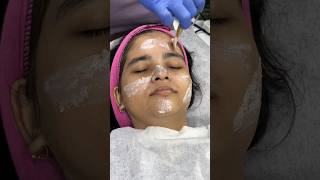 Facial amp Hair Treatment 👍 mariakhan shorts ☎️ 7977236473 DrKSkinHairAdvanceLaserClinic [upl. by Schinica]