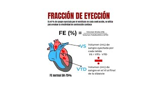 Insuficiencia cardíaca Casos clínicos  Dr Rafael Rascón Sabido [upl. by Oner358]