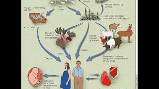 Congenital Toxoplasmosis [upl. by Terrilyn151]