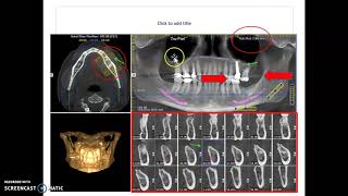 Dental CBCT Scans [upl. by Adnaugal]