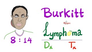 Burkitt’s Lymphoma  Diagnosis and Treatment  NonHodgkins Lymphoma  Aggressive Neoplasm [upl. by Orapma24]