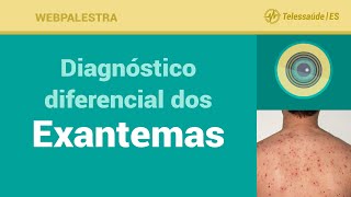 Webpalestra Diagnóstico diferencial dos Exantemas  Telessaúde ES 02062016 [upl. by Swain]