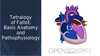 Tetralogy of Fallot Basic Anatomy and Pathophysiology by P Lang L DelSignore  OPENPediatrics [upl. by Adna]