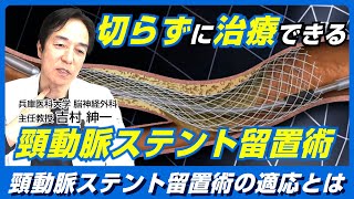 切らずに治療できる！頚動脈ステント留置術CASとは？脳神経外科医 吉村紳一Drが徹底解説！ [upl. by Gillan]