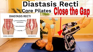 Diastasis Recti Core and Abdominal Strengthening Pilates Program with Dumbbells Progression [upl. by Orion629]