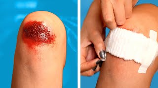 SAFETY HACKS AND FIRST AID 😰  TRUQUES DE PRIMEIROS SOCORROS  Dicas DIY e Situações Divertidas [upl. by Ethelinda]