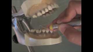 1 Probing Mandibular Right Buccal Surfaces [upl. by Safko]