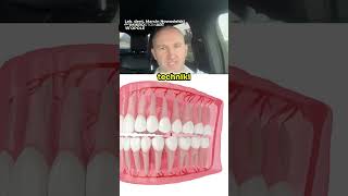 Czy Usuwanie Ósemek Boli 😳😱 Animacja 3D Dentystyczna [upl. by Koslo564]