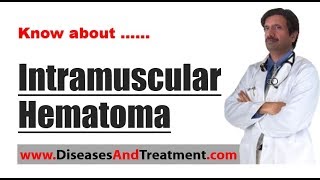 Intramuscular Hematoma Hematoma  Causes Symptoms Diagnosis Treatment Prevention [upl. by Nayab]