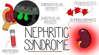 Understanding Nephritic Syndrome With Pathology Made Easy [upl. by Newcomer]