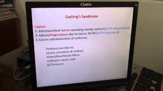 Endocrine DrHani Gamal Disturbance of adrenocortical hormones [upl. by Wohlert]