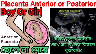 গর্ভে ছেলে না মেয়ে প্লাসেন্টার পজিসন Placenta Anterior Boy Or Girlbabybabyboyboy fhrpregnancy [upl. by Carrie]