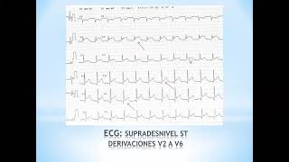 Cátedra de Clínica Médica I  Enf del Pericardio 1° parte [upl. by Alisia]