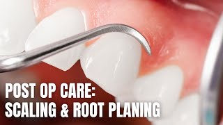 Post Op Care Scaling amp Root Planing [upl. by Anitak]