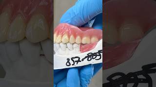 Upper Denture and Lower Posterior Bite Block lsk121shorts dentist teeth [upl. by Doone670]