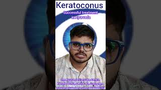 Keratoconus  Ayurveda eye Treatment [upl. by Eirak415]